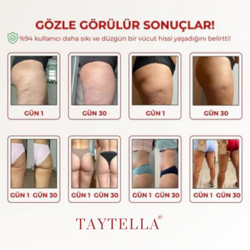 3'lü Etki Taytı Lipödem, Selülit, Varis Taytella™