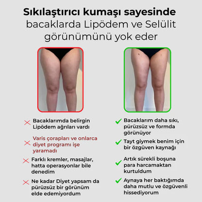 3'lü Etki Taytı Lipödem, Selülit, Varis Taytella™